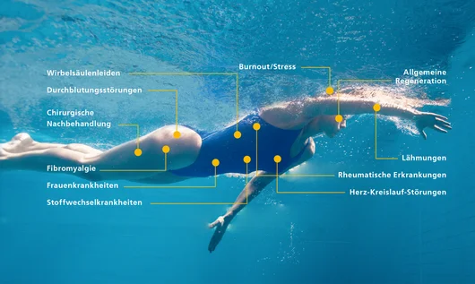 Gesundheitsprobleme beim Schwimmen Eine Frau schwimmt im Wasser. Textetiketten sind sichtbar, die auf verschiedene gesundheitliche Probleme hinweisen, wie z.B. Fibromyalgie, Lähmungen und Stress.
